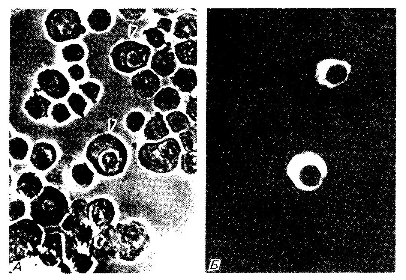     ,        IgG<sub>2b</sub>,   .